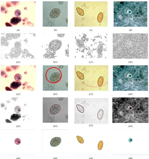 Figure 3. Segmentation results with initial LSF outside the parasite. (a), (b), (c), (d) are original images, (a1), (b1), (c1), (d1) are results of edge detection