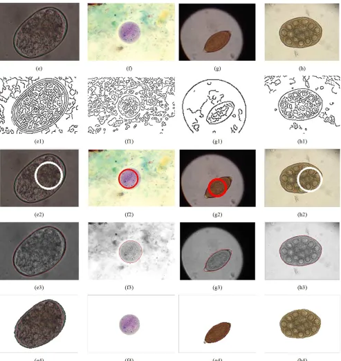 Figure 4. Segmentation results with initial LSF inside the parasite. (e), (f), (g), (h) original images, (e1), (f1), (g1), (h1) are results of edge detection