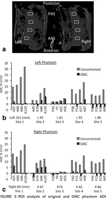 Figure 3a shows typical ROIs drawn at different AP positions in the two ice-water phantoms, with ADC results plotted in Fig