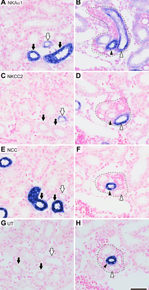 Fig. 5B). In the LDT, the transitional segment from the EDT to the