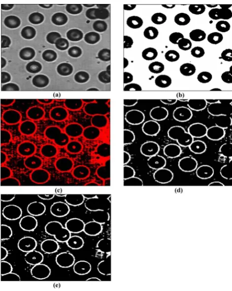 Figure 5(b) shows the binary image of chip image by moment A segmented image of micro chip is displayed in Fig.5 (a)