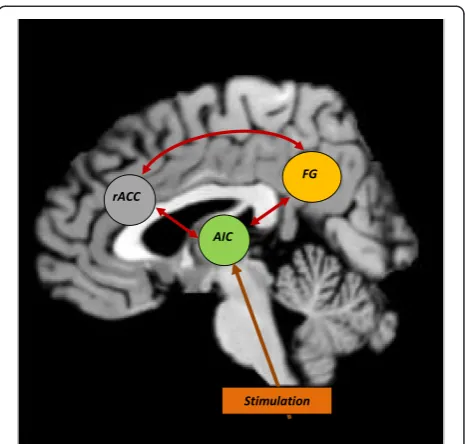 Figure 1 Topographical representation of the brain regionsillustrated by the meta-analysis