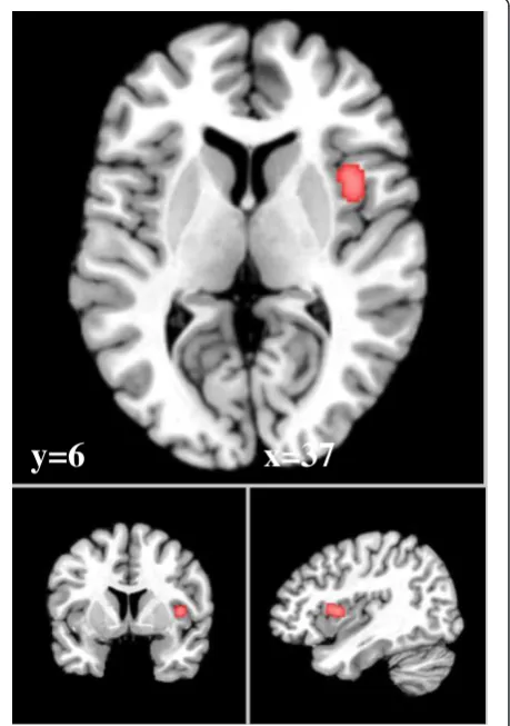 Table 2 Results of the ALE analyses, with significantly activated brain regions