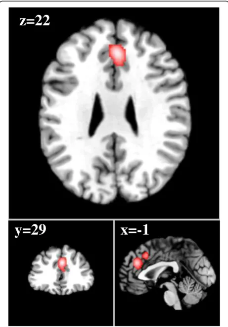 Figure 4 Caudal anterior cingulate cortex (both subliminal andsupraliminal). Red cluster: subliminal > supraliminal analysis (x = 2,y = 32, z = 36), cluster size of 920 voxels mm2, ALE value = 2.52.Green cluster: supraliminal > subliminal analysis (x = 0, 
