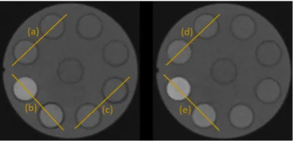 Figure 5.Material decomposition of concentration phantoms using (a) Segmentation variant and (b)Angular Rejection variant of MARS-MD showing gold, gadolinium, calcium, and iodine channels fusedwith the highest energy bin.