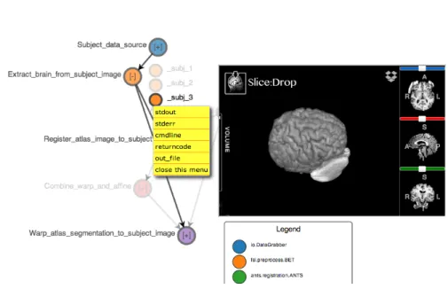 Fig. 3. Clicking on the orange visual node in Fig. 1 produces this visualization of the result of the brain extraction step using Slice:Drop