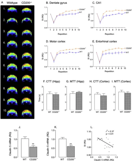 Fig. 7. BBB permeability is increased in hippocampus and cortex of CD200�/� mice. Signal intensity (SI) generated by extravasation of the gadolinium-based contrast agent,gadopentate dimeglumine, was used to assess BBB permeability using MRI