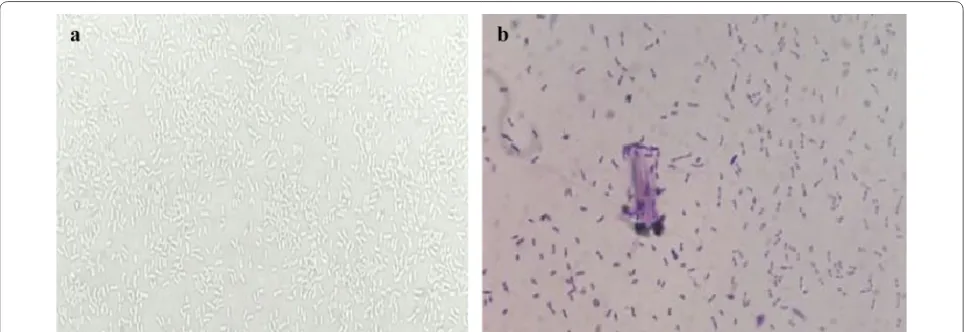 Fig. 1 Microscope picture of the EB-06 strain: a unstained bacterial morphology (10×1000); b stained bacterial morphology (10×1000)