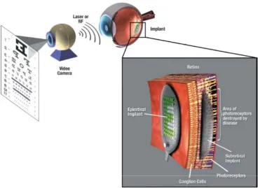 Figure 1.2. System overview and comparison of locations of epiretinal and subretinal implants [13]