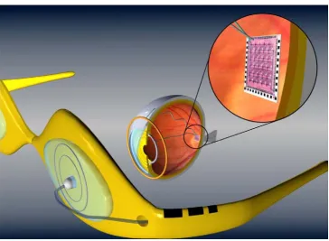 Figure 1.3. Basic components for the retinal implant system. (Image courtesy from www.thinfilmsblog.com) 