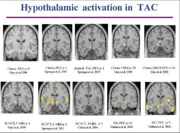Fig. 2 Summary of current func-tional imaging studies in differentforms of trigeminal autonomicheadache syndromes [22, 87, 88,90–92, 95–97]