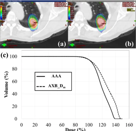 Figure 1 shows dose distributions and DVH for the patient with the largest difference between  the AXB_D m  and the AAA