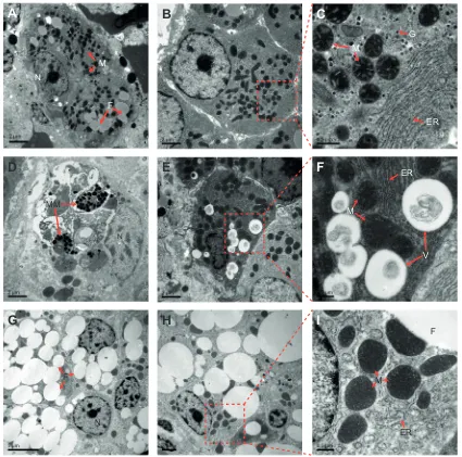 Fig. 2. Transmission electron micrographs of hepatic cells from Q. spinosa under cold and heat stress