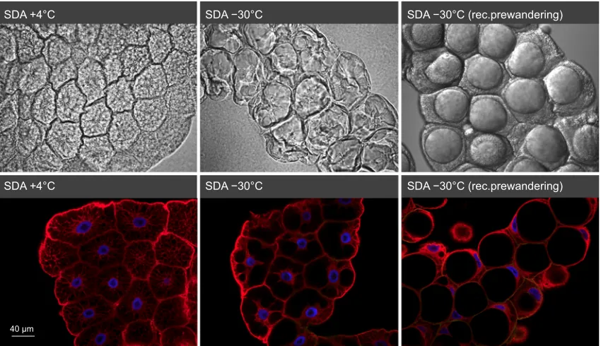 Fig. 1. Lipid droplet morphology in fat body cells before sublethal freezing (left), upon sublethal freezing (middle) and after recovery to theprewandering stage (right) in cold-acclimated, diapausing (SDA) malt fly larvae (confocal microscopy, mid-section