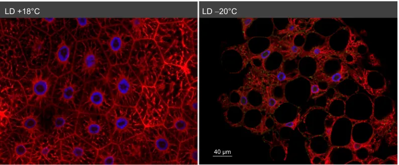 Fig. 2. Morphology of αper treatment (microscopy, mid-section).-tubulin in the fat body of unfrozen (left) and lethally frozen (right) active, long-day-reared (LD) malt fly larvae (confocal Fluorescence staining: α-tubulin (anti-α-tubulin antibody, red), F