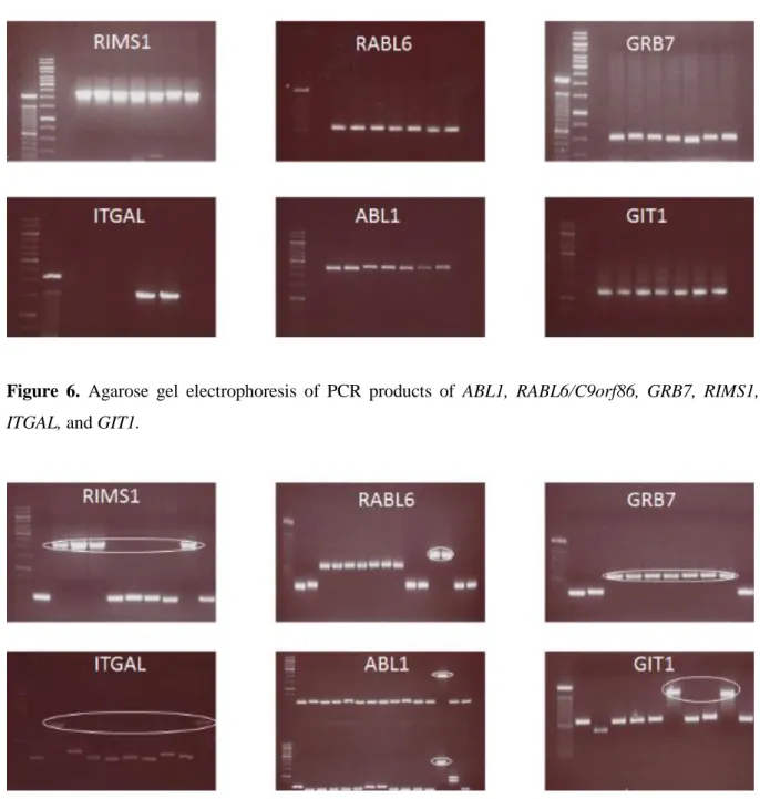 Figure  6.  Agarose  gel  electrophoresis  of  PCR  products  of  ABL1,  RABL6/C9orf86,  GRB7,  RIMS1,  ITGAL, and GIT1