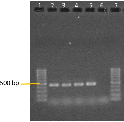 Figure 3.4: 1% agarose gel bands of RFLP digested with EcoR1 enzyme. Ten PCR products showing 