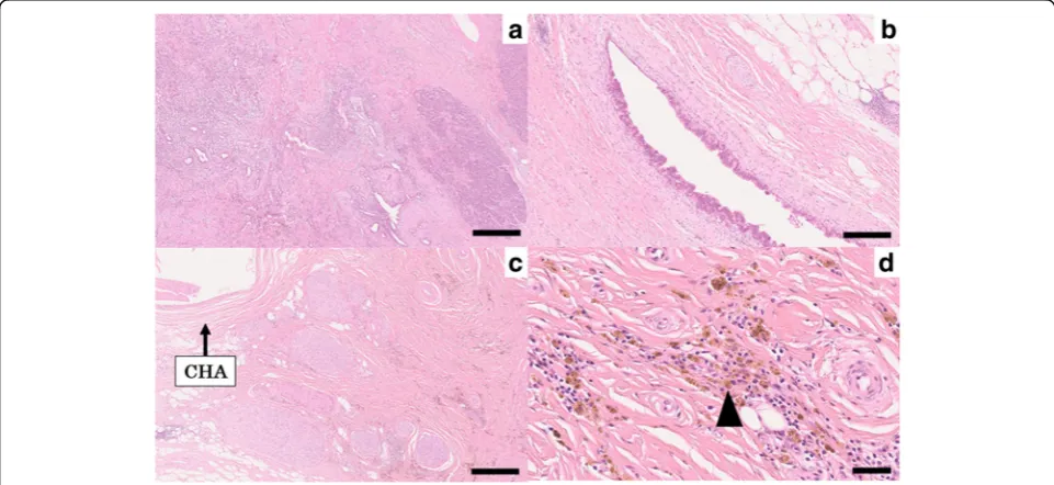 Fig. 4 FDG-PET after three subsequent courses of GS. The maintumor of the pancreatic body had an abnormal accumulation ofSUV max 3.8