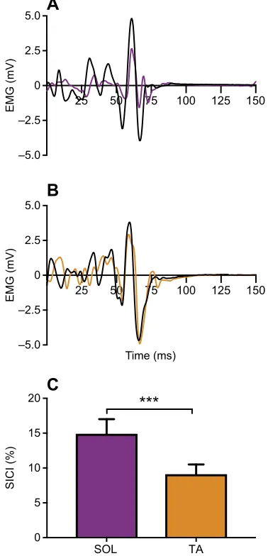 Fig. 1. Representative responses to transcranial magnetic stimulation(TMS) in one subject when the soleus (SOL) and tibialis anterior (TA) wereacting as agonists