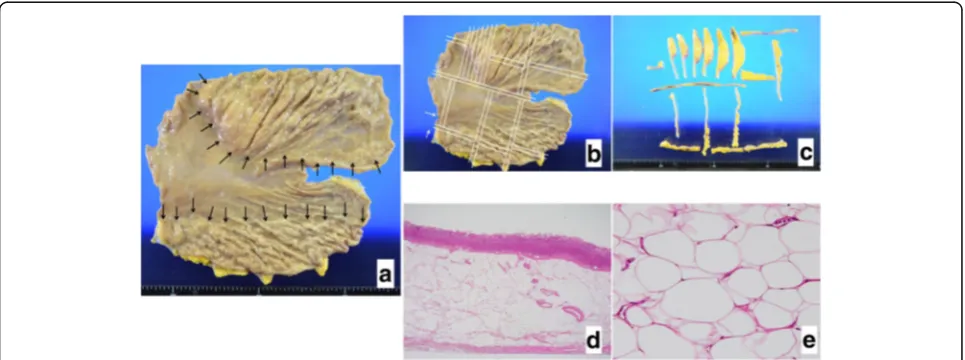 Fig. 3 Findings on T1- and T2-weighted MRI. T1- (a) and T2-weighted (b) MRI findings are shown