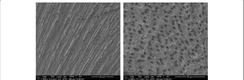 Fig. 2 Negative control. Upon completion of instrumentation, NaOCl was inactivated with 5% sodium thiosulfate for 5 min followed by irrigationwith 5 mL of 17% EDTA for 1 min to ensure the complete removal of smear layer