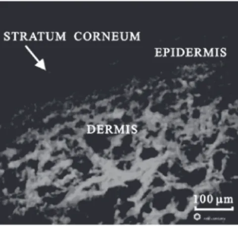 Figure 6. Experimental auto-fluorescence image of skin tissue section under illumination of 442 nm laser radiation (courtesy of Zeng [19], with permission).
