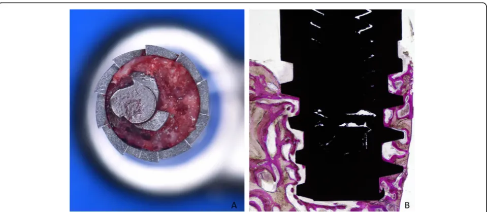 Fig. 3 a Trephine used in an eccentric way to reduce the size of the biopsies. b Ground section illustrating the shape of the biopsies