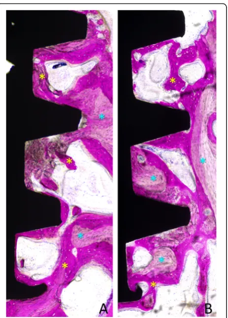 Fig. 5 a, b Photomicrographs of ground sections of devicesinstalled with old bone (light blue stars)