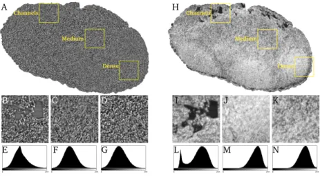 Figure 1: Different regions used to evaluate the effect of areas of the node on the flow pathways in the model for A) Gridrec reconstruction and H) Paganin reconstruction