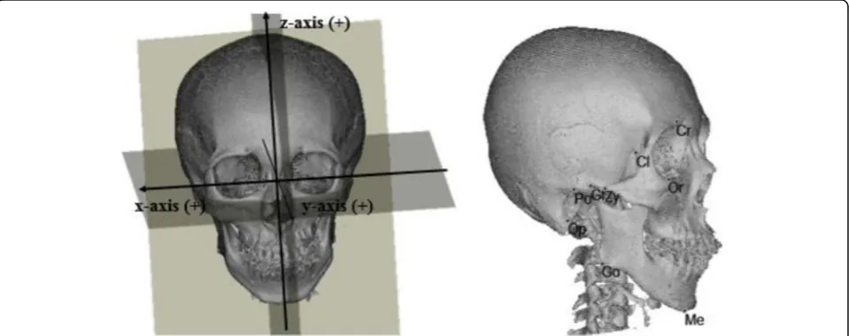 Fig. 1 Three-dimensional reference planes and craniofacial landmarks. Cr, crista galli; Cl, clinoid process; Op, opisthion; Po, porion; Me, menton;Go, gonion; Gf, glenoid fossa; Or, orbitale; Zy, zygonion