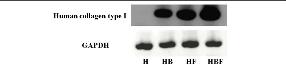 Fig. 7 RT-PCR of human collagen type I. Human type I collagen was detected in hydrogel combined with bFGF (HB), hydrogel combined withfibroblasts (HF), and hydrogel mixed with bFGF and fibroblasts (HBF)