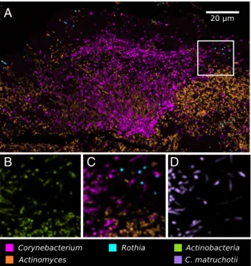 Fig. 6. Localization of Actinomyces within hedgehogs, in patches within the base region of hedgehogs, and adjacent to them.