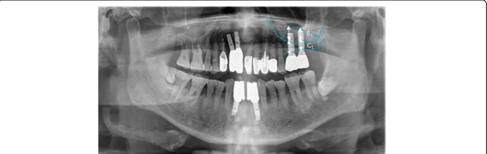 Table 1 Postoperative complications