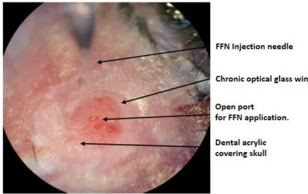 Figure 2. Diagramed image of an implanted cranial window with a chronic glass port for  nanoinjecting FFN