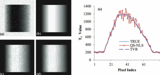Figure 5 shows T 1 maps of the 18-compartment RIDER phantom estimated by the QS-NLS, QR, and TVR methods