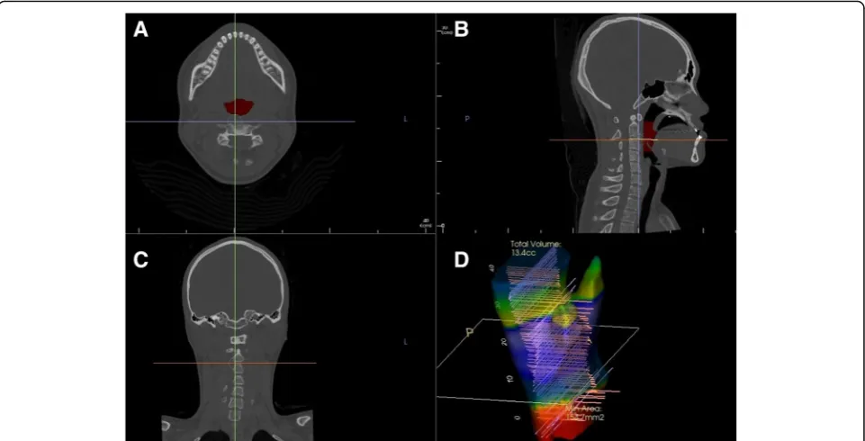 Fig. 1 DICOM file is reconstructed into four basic views.width of the airway parameters were measured