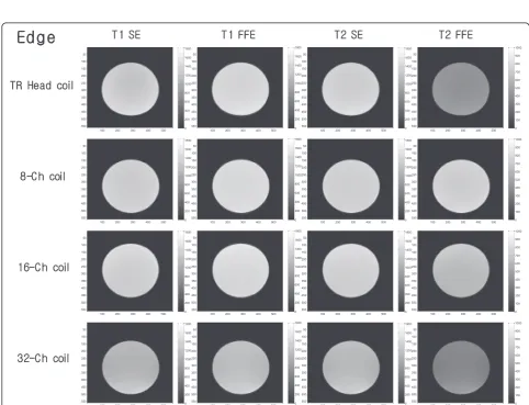 Figure 1 SE and FE pulse sequence diagrams. Left, SE; right, FE.