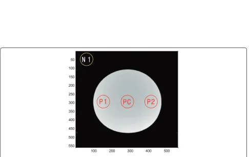 Figure 5 Slice signal intensity profile of the edge slice images.