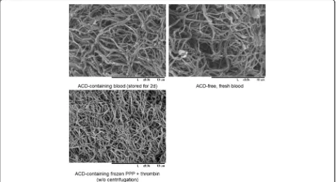 Fig. 3 SEM examination of fibrin fibers formed in self-clotted PRF and thrombin-stimulated PPP clots