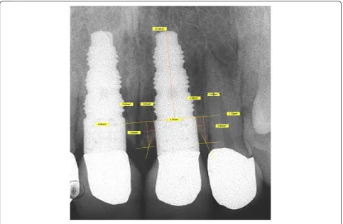 Fig. 5 Measurement specifications: clinical realization [6]