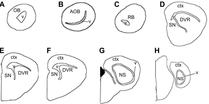 Fig. 1. Schematic drawings showing coronal