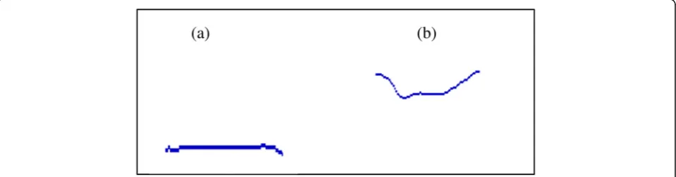 Fig. 2 Nasogram slope types of Vietnamese cleft palate children