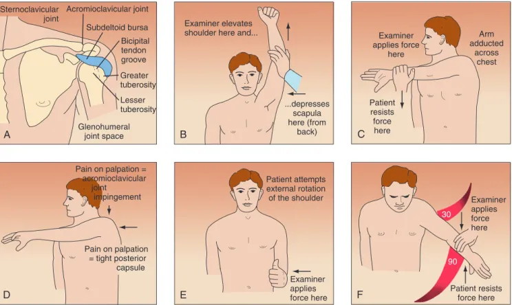 Figure 46-3  A, Tenderness on palpation of trigger points may help localize the site of pathology