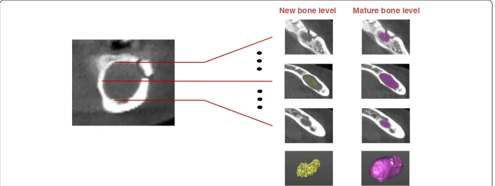 Fig. 2 Selection of pixels within the range of Hounsfield units desired (selection process).c a Original CBCT image