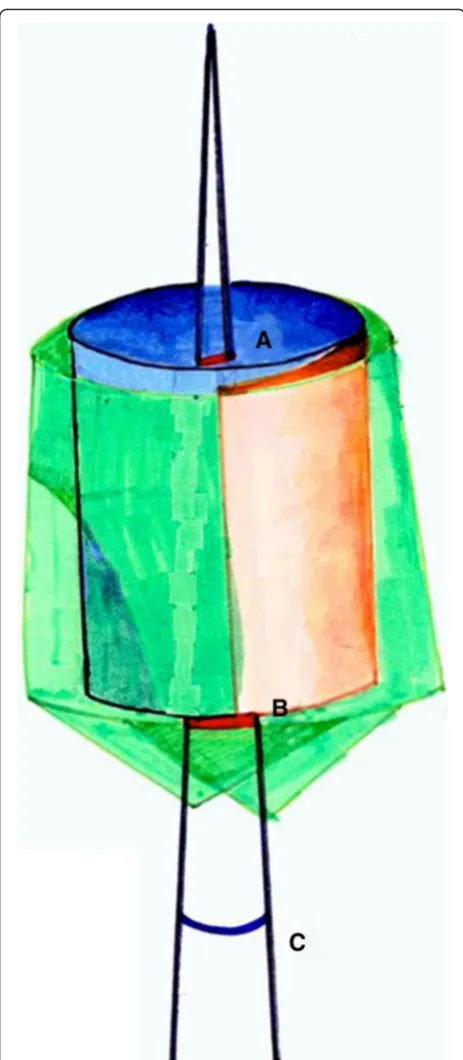 Fig. 4 The angular and distance (shoulder/apical) error analysis ofthe preoperative and postoperative implant fixture body