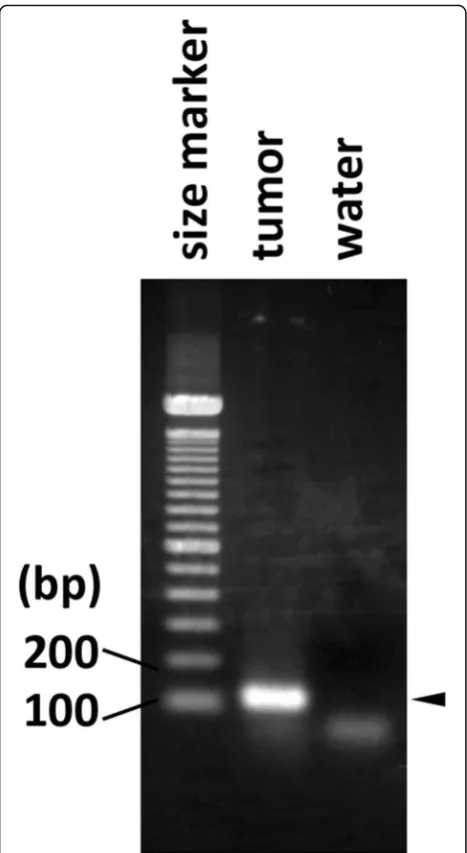 Fig. 6 RT-PCR findings. Identification of the parathyroid hormonethetranscript in tumor RNA by RT-PCR