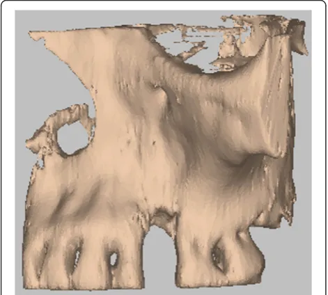 Fig. 3 Hydroxyapatite bone graft, built using CAD/CAM