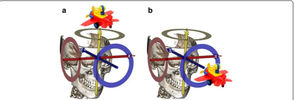 Fig. 2 Proximal segment rotation in each plane. a. Proximal segment-sagittal rotation (P-SR)