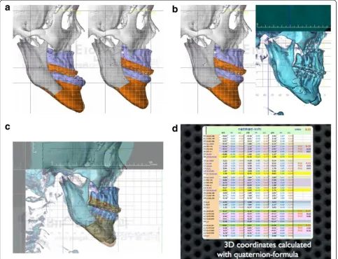 Fig. 7 Evaluation phase. a. Simulated surgical image (Left: Pre-operative view, Right: Post-operative view)