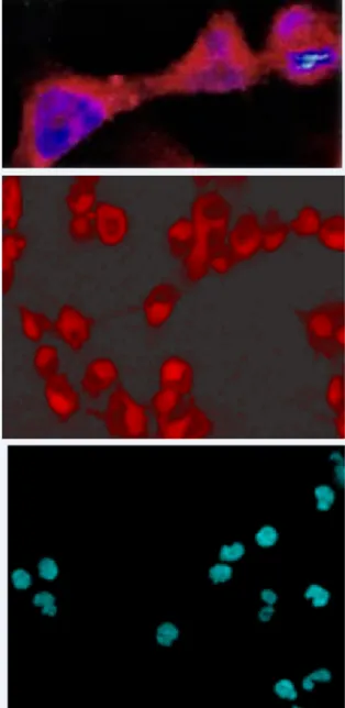 Figure 2 illustrates the uptake of liposomal ICG after 4 h in 